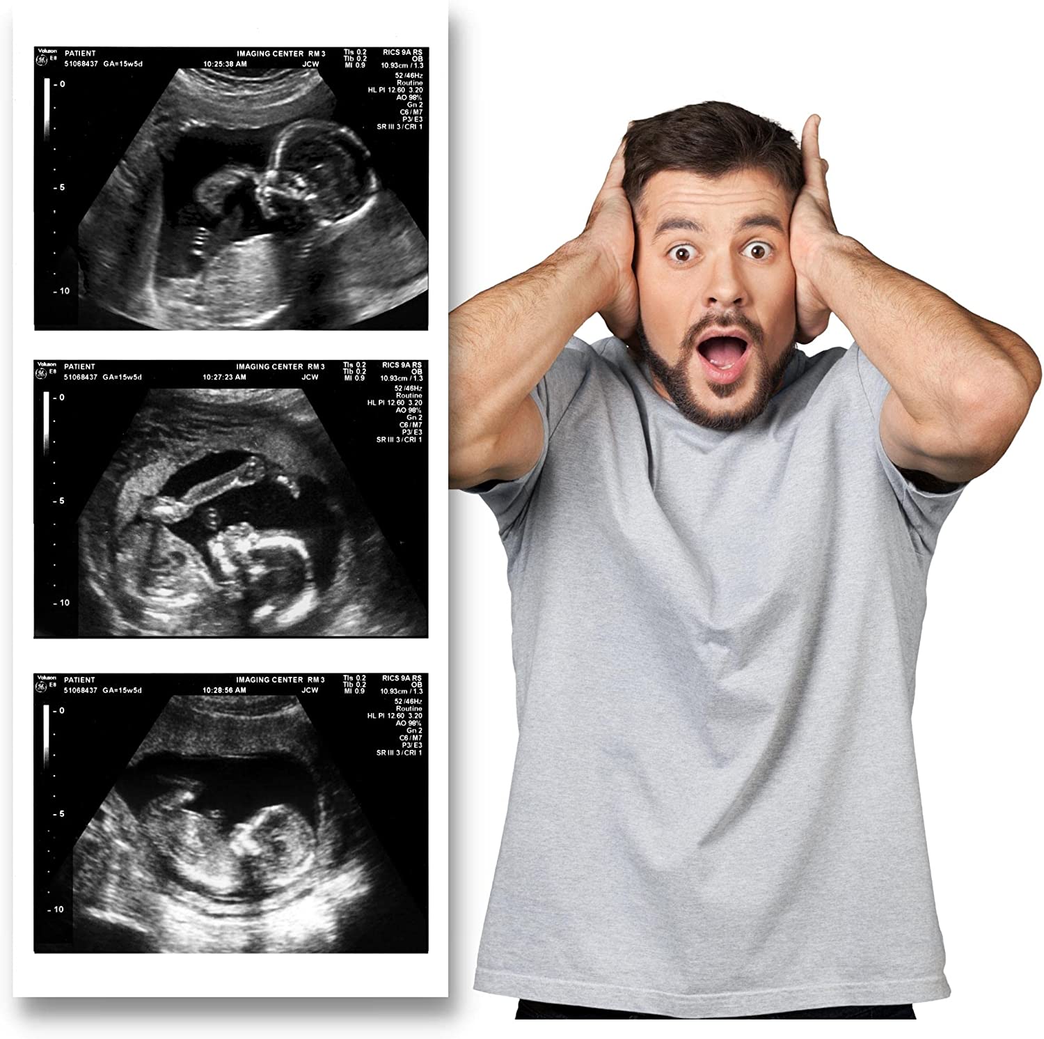How to use a personalized fake sonogram to prank your friends and family? post thumbnail image